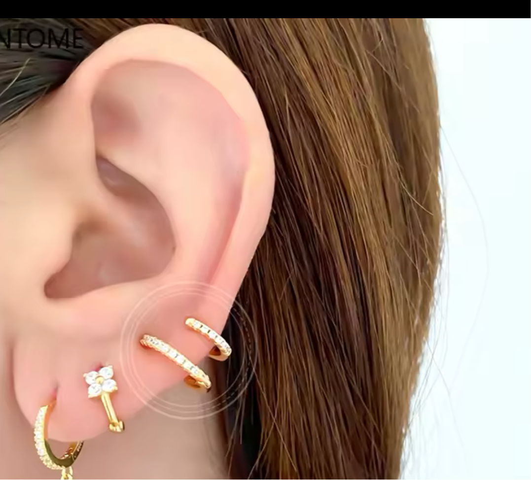 Arete
