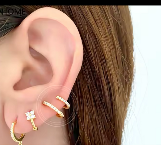 Arete